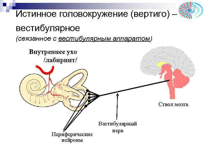 Истинное головокружение (вертиго) – вестибулярное (связанное с вестибулярным аппаратом) Внутреннее ухо /лабиринт/ Ствол мозга