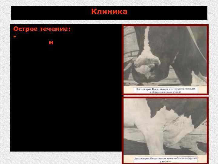 Клиника Острое течение: - небольшие некротические участки на слизистых оболочках десен, языка, на коже