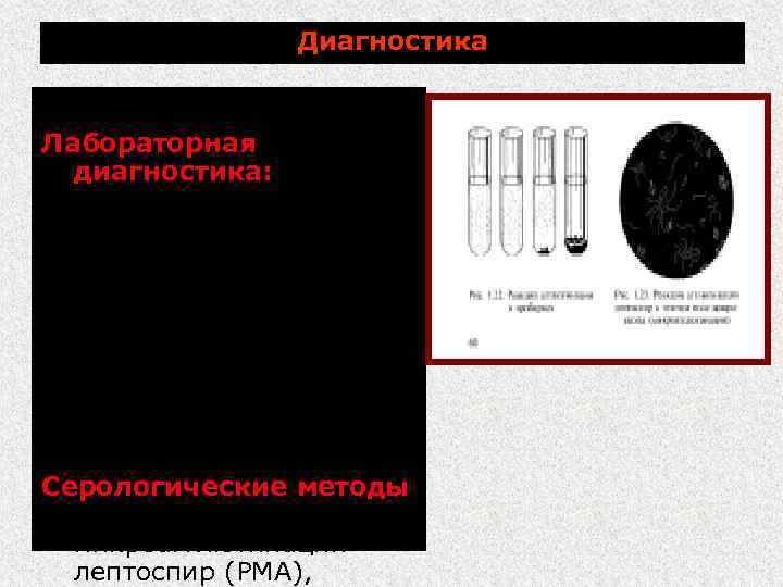 Диагностика комплексная. Лабораторная диагностика: микробиологические и иммунологические методы (прямая микроскопия биоматериала, ПЦР, выделение чистых