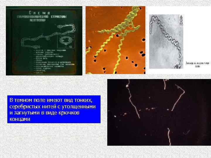 В темном поле имеют вид тонких, серебристых нитей с утолщенными и загнутыми в виде