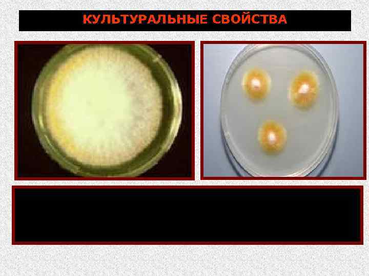 КУЛЬТУРАЛЬНЫЕ СВОЙСТВА сусло агар, сред Сабуро и другие питательные среды при температуре 27. .