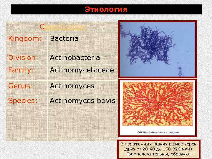 Этиология Classification Kingdom: Bacteria Division Actinobacteria Family: Actinomycetaceae Genus: Actinomyces Species: Actinomyces bovis В