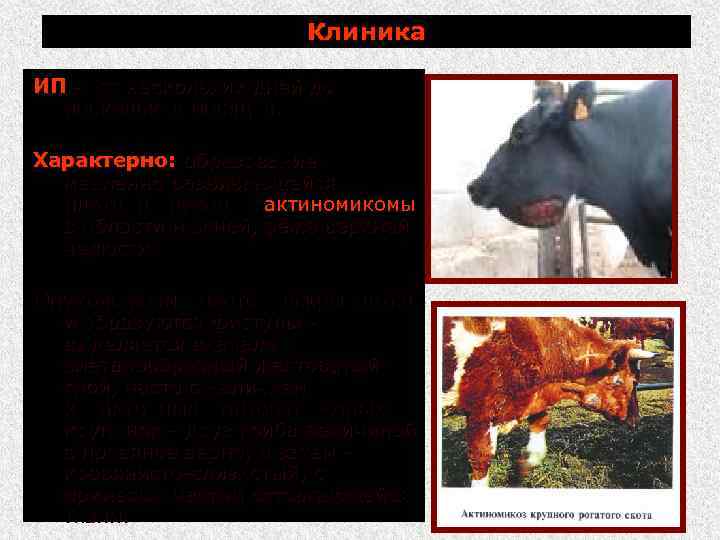 Клиника ИП от нескольких дней до нескольких месяцев. Характерно: образование медленно развивающейся плотной опухоли