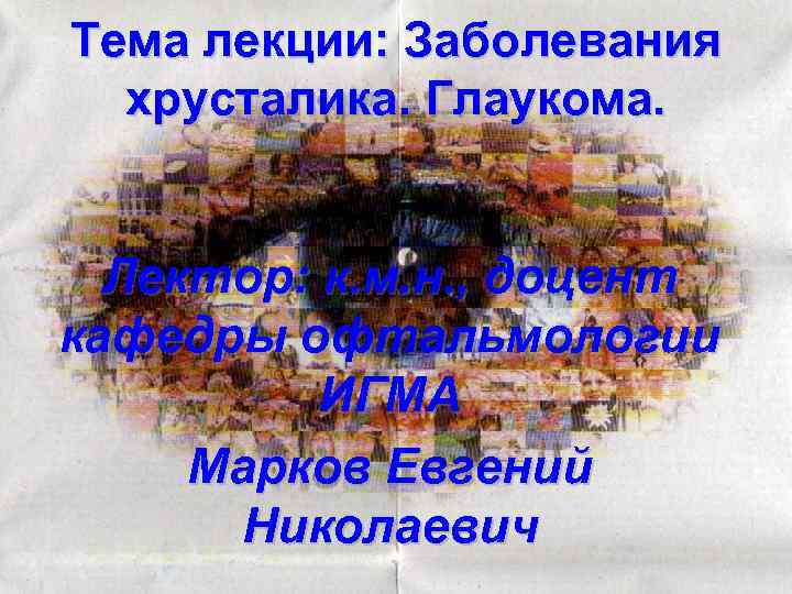 Тема лекции: Заболевания хрусталика. Глаукома. Лектор: к. м. н. , доцент кафедры офтальмологии ИГМА