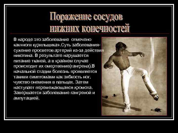 В народе это заболевание отмечено как» ноги курильщика» . Суть заболеваниясужение просветов артерий из-за
