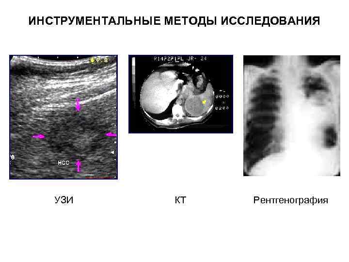 ИНСТРУМЕНТАЛЬНЫЕ МЕТОДЫ ИССЛЕДОВАНИЯ УЗИ КТ Рентгенография 