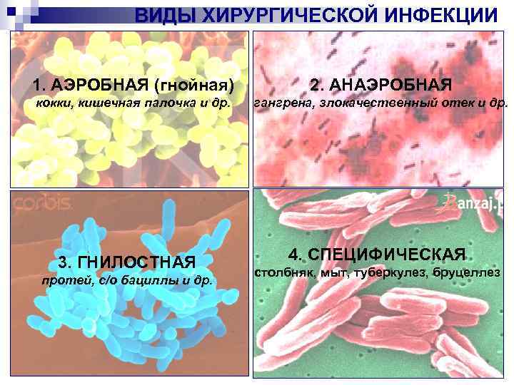 Хирургическая инфекция картинки