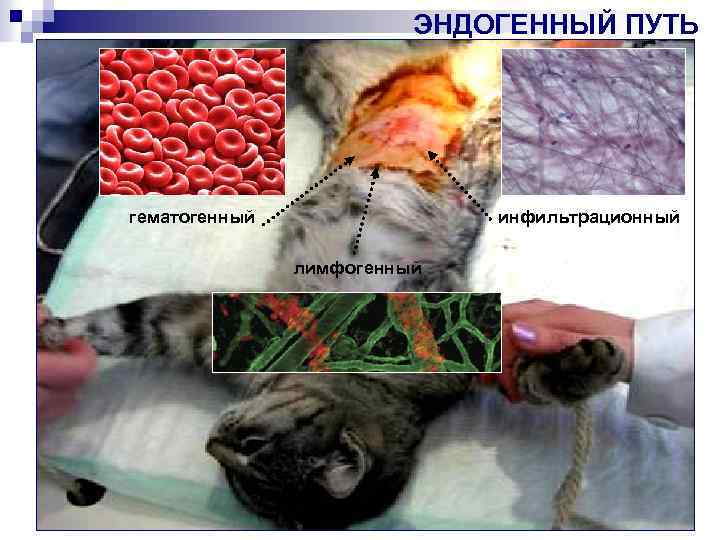 ЭНДОГЕННЫЙ ПУТЬ гематогенный инфильтрационный лимфогенный 