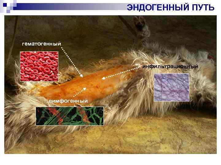 ЭНДОГЕННЫЙ ПУТЬ гематогенный инфильтрационный лимфогенный 