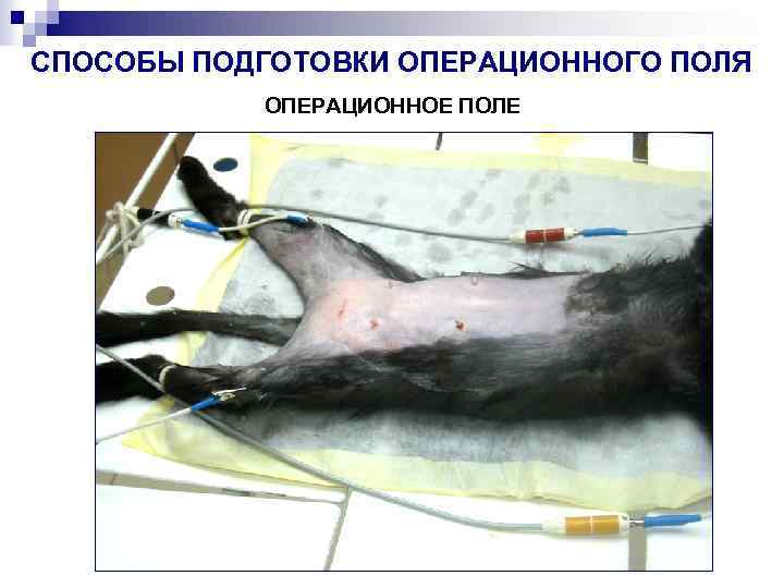 СПОСОБЫ ПОДГОТОВКИ ОПЕРАЦИОННОГО ПОЛЯ ОПЕРАЦИОННОЕ ПОЛЕ 