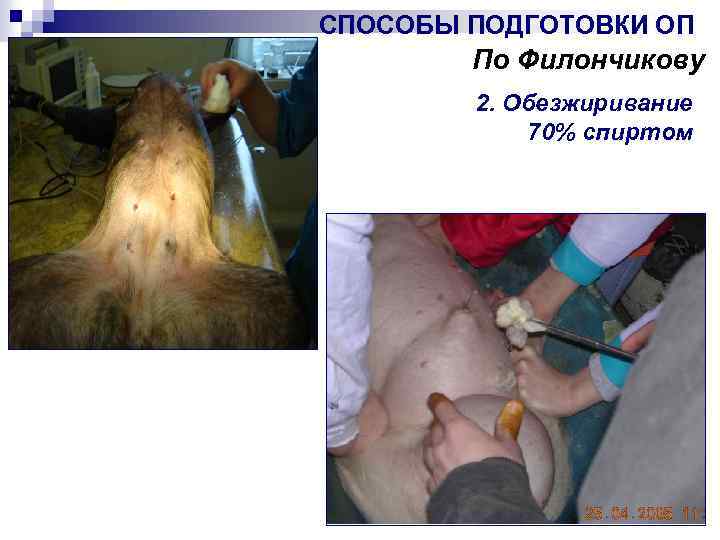 СПОСОБЫ ПОДГОТОВКИ ОП По Филончикову 2. Обезжиривание 70% спиртом 