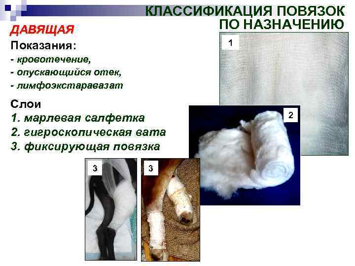 КЛАССИФИКАЦИЯ ПОВЯЗОК ПО НАЗНАЧЕНИЮ ДАВЯЩАЯ Показания: 1 - кровотечение, - опускающийся отек, - лимфоэкстаравазат