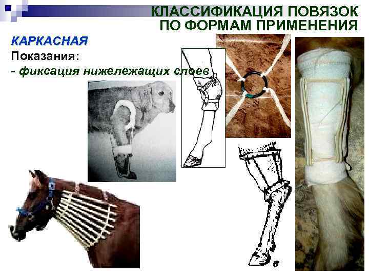 КЛАССИФИКАЦИЯ ПОВЯЗОК ПО ФОРМАМ ПРИМЕНЕНИЯ КАРКАСНАЯ Показания: - фиксация нижележащих слоев 