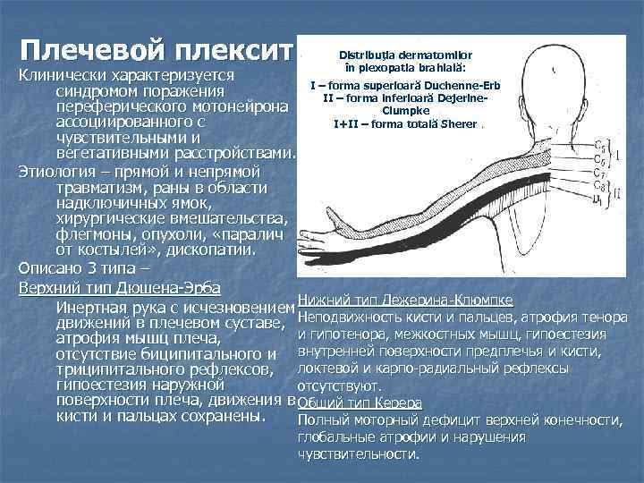 Плечевой плексит Distribuţia dermatomilor în plexopatia brahială: Клинически характеризуется I – forma superioară Duchenne-Erb