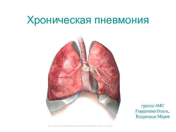 Пневмония 4. Хроническая пневмония. Хроническая пн. Хроническая пневмония симптомы. Хроническая пневмония презентация.