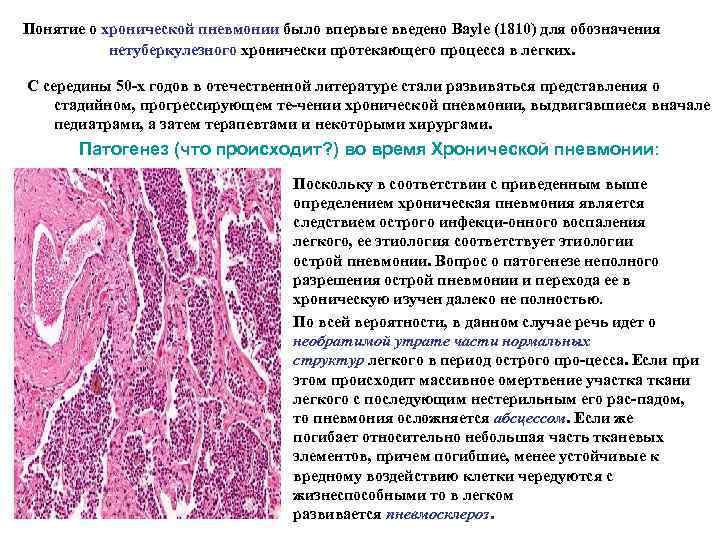 Понятие о хронической пневмонии было впервые введено Bayle (1810) для обозначения нетуберкулезного хронически протекающего