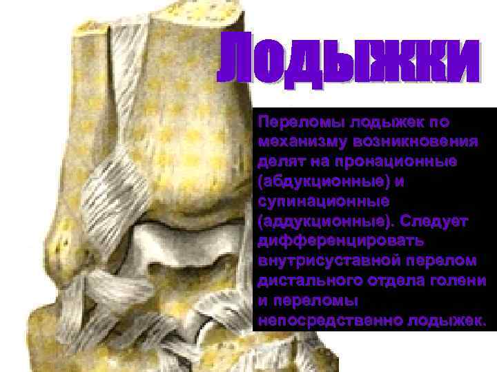 Лодыжки Переломы лодыжек по механизму возникновения делят на пронационные (абдукционные) и супинационные (аддукционные). Следует