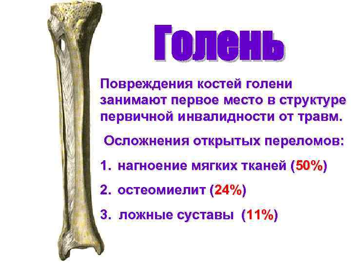 Голень Повреждения костей голени занимают первое место в структуре первичной инвалидности от травм. Осложнения