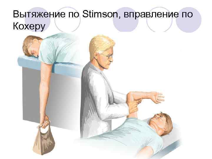 Вытяжение по Stimson, вправление по Кохеру 