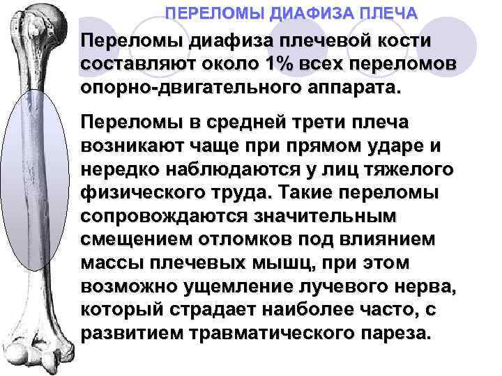 Средняя треть плечевой кости. Перелом средней трети диафиза плечевой кости. Перелом диафиза плечевой кости в верхней трети. 3. Клиника перелома диафиза плечевой кости.. Переломах диафиза плечевой кости в с/3.