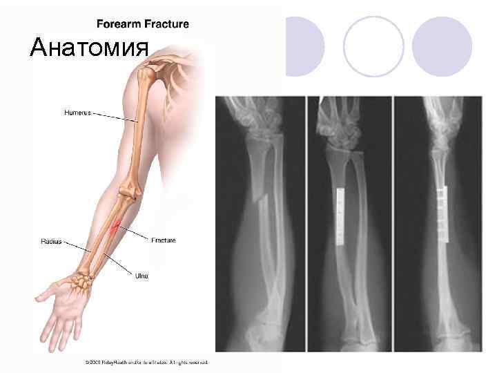 Где находится предплечье у человека фото 4 класс