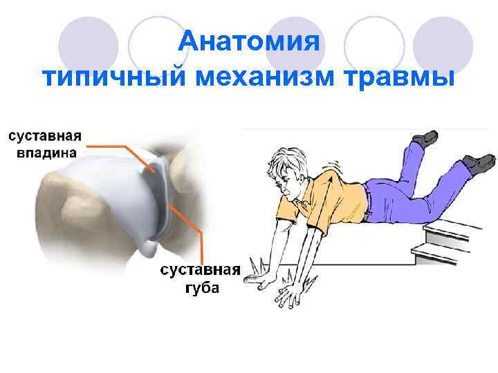 Повреждения нижних конечностей презентация