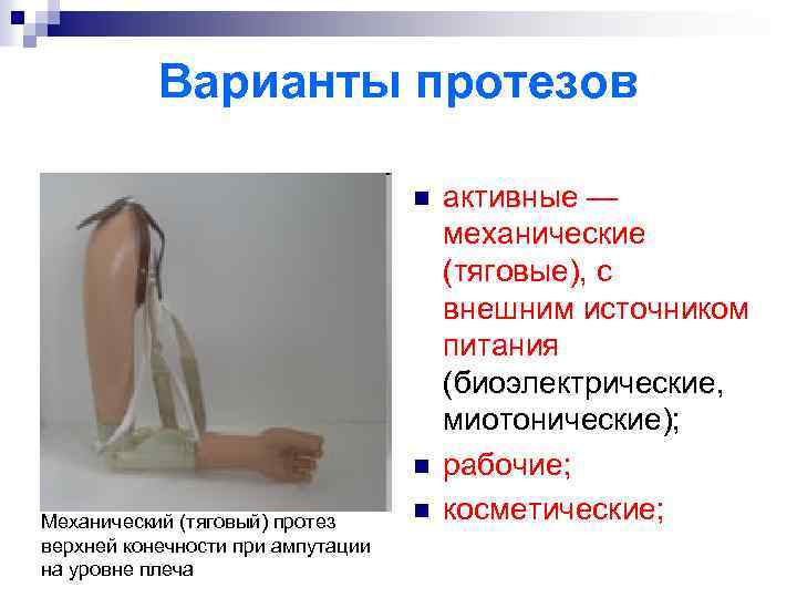 Варианты протезов n n Механический (тяговый) протез верхней конечности при ампутации на уровне плеча