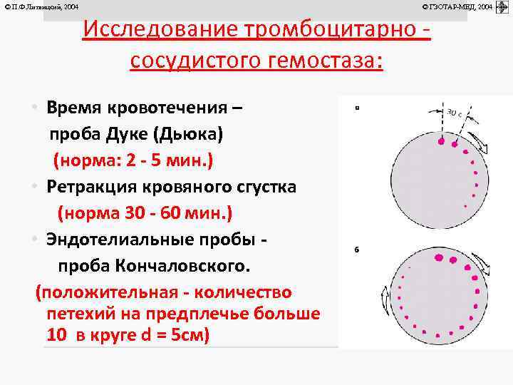 Время кровотечения. Длительность кровотечения по Дьюку норма. Длительность кровотечения по Дуке норма. Длительность кровотечения по Дьюку норма у детей. Методика определения длительности кровотечения.