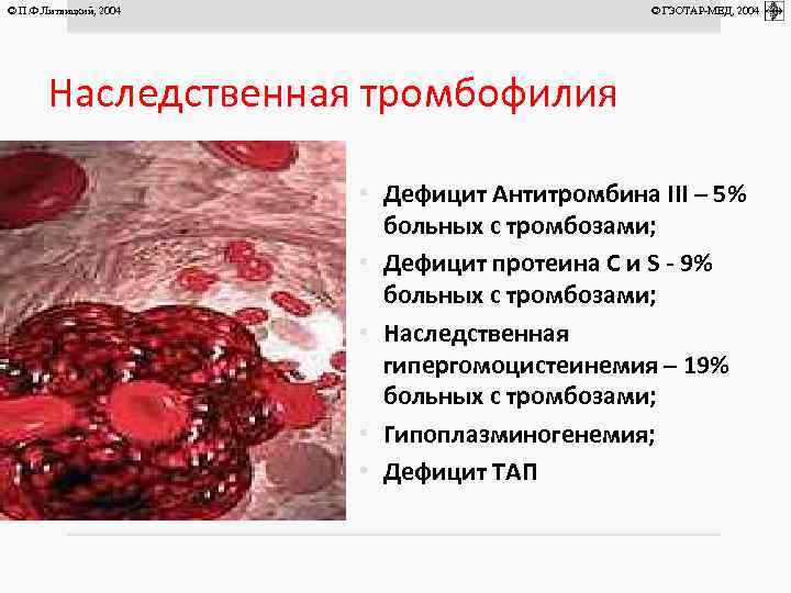 © П. Ф. Литвицкий, 2004 © ГЭОТАР-МЕД, 2004 Наследственная тромбофилия • Дефицит Антитромбина III