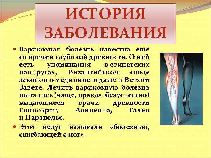 ИСТОРИЯ ЗАБОЛЕВАНИЯ Варикозная болезнь известна еще со времен глубокой древности. О ней есть упоминания