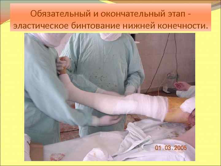 Обязательный и окончательный этап эластическое бинтование нижней конечности. 