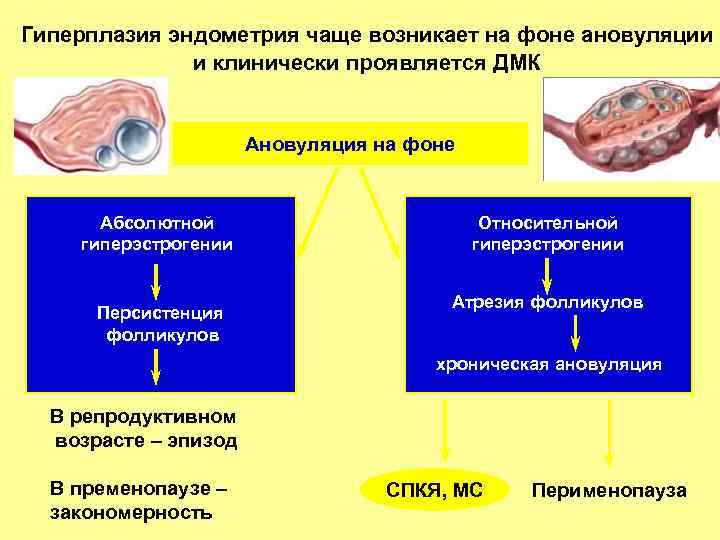 Гиперплазия эндометрия чаще возникает на фоне ановуляции и клинически проявляется ДМК Ановуляция на фоне