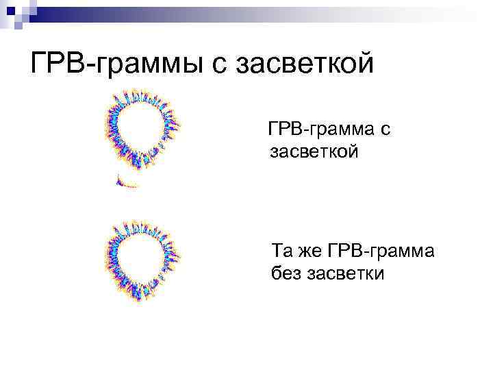 ГРВ-граммы с засветкой ГРВ-грамма с засветкой Та же ГРВ-грамма без засветки 