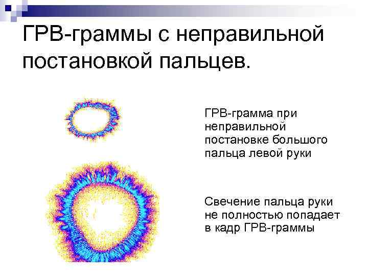 ГРВ-граммы с неправильной постановкой пальцев. ГРВ-грамма при неправильной постановке большого пальца левой руки Свечение