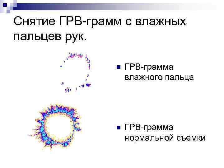 Снятие ГРВ-грамм с влажных пальцев рук. n ГРВ-грамма влажного пальца n ГРВ-грамма нормальной съемки