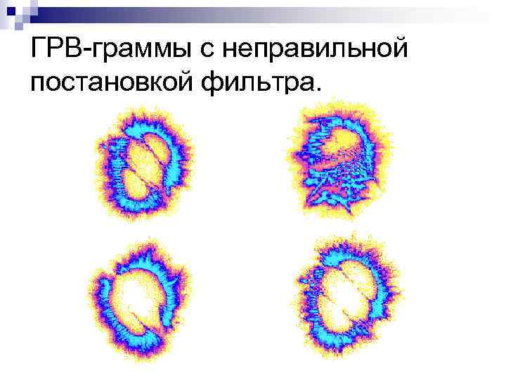 ГРВ-граммы с неправильной постановкой фильтра. 