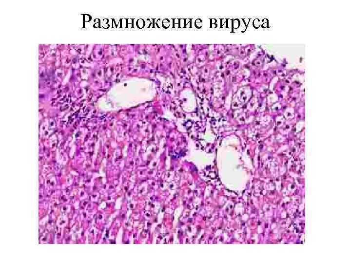 Размножение вируса 