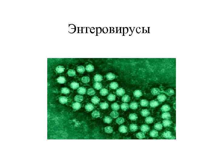 Энтеровирусы 