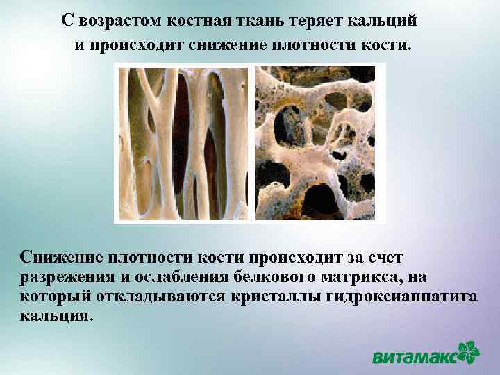 Уменьшение костной ткани. Матрикс костной ткани. Снижение плотности кости. Костная ткань. Формирующаяся костная ткань.