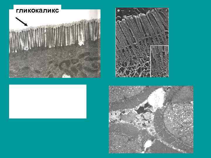 гликокаликс 