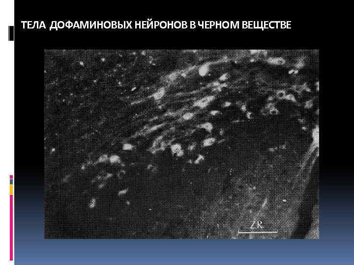 ТЕЛА ДОФАМИНОВЫХ НЕЙРОНОВ В ЧЕРНОМ ВЕЩЕСТВЕ 