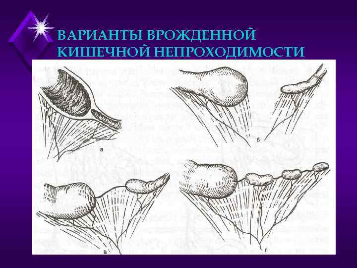 Схема формирования малого экспериментального желудочка по павлову