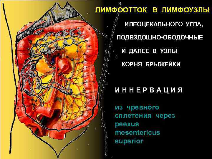 ЛИМФООТТОК В ЛИМФОУЗЛЫ ИЛЕОЦЕКАЛЬНОГО УГЛА, ПОДВЗДОШНО-ОБОДОЧНЫЕ И ДАЛЕЕ В УЗЛЫ КОРНЯ БРЫЖЕЙКИ И Н