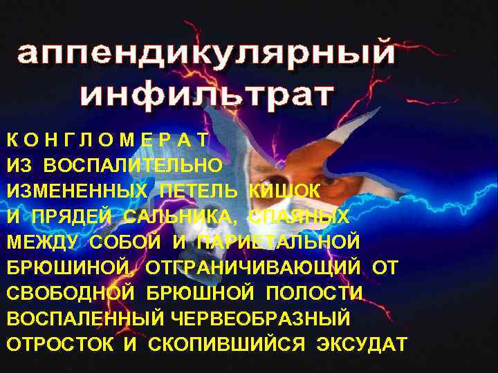 КОНГЛОМЕРАТ ИЗ ВОСПАЛИТЕЛЬНО ИЗМЕНЕННЫХ ПЕТЕЛЬ КИШОК И ПРЯДЕЙ САЛЬНИКА, СПАЯНЫХ МЕЖДУ СОБОЙ И ПАРИЕТАЛЬНОЙ