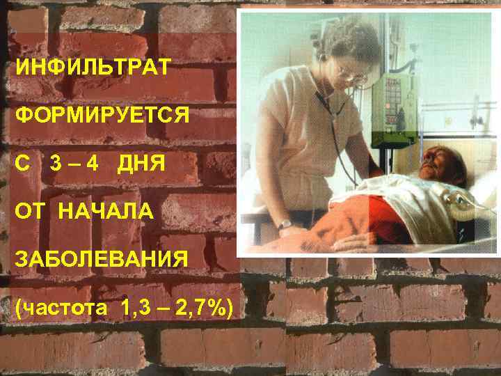 ИНФИЛЬТРАТ ФОРМИРУЕТСЯ С 3 – 4 ДНЯ ОТ НАЧАЛА ЗАБОЛЕВАНИЯ (частота 1, 3 –
