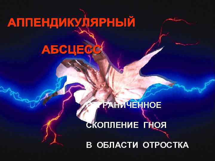 ОТГРАНИЧЕННОЕ СКОПЛЕНИЕ ГНОЯ В ОБЛАСТИ ОТРОСТКА 