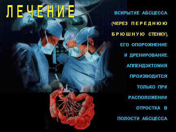 ВСКРЫТИЕ АБСЦЕССА (ЧЕРЕЗ П Е Р Е Д Н Ю Ю Б Р Ю