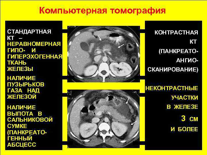 Компьютерная томография поджелудочной железы как проходит