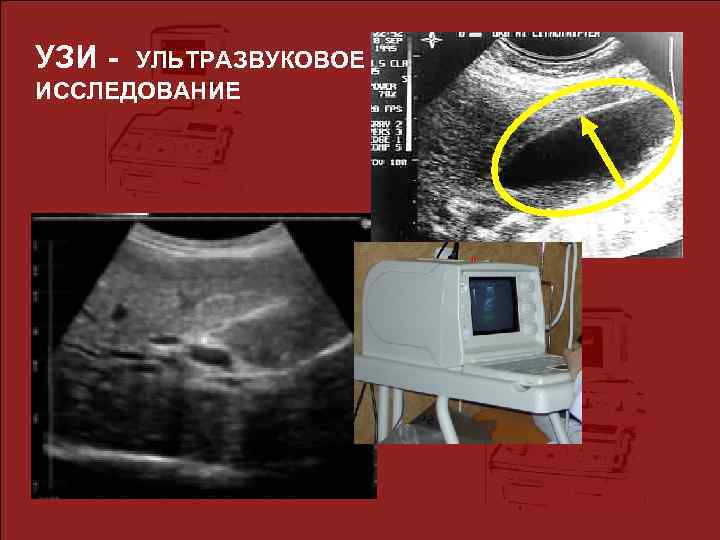 УЗИ - УЛЬТРАЗВУКОВОЕ ИССЛЕДОВАНИЕ 
