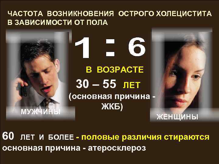 ЧАСТОТА ВОЗНИКНОВЕНИЯ ОСТРОГО ХОЛЕЦИСТИТА В ЗАВИСИМОСТИ ОТ ПОЛА В ВОЗРАСТЕ 30 – 55 МУЖЧИНЫ